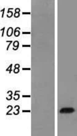 Novus Biologicals&trade;&nbsp;Growth Hormone Overexpression Lysate