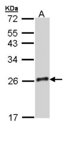 Growth Hormone 2 Antibody, Novus Biologicals 100 &mu;L | Buy Online | Novus Biologicals | Fisher Scientific