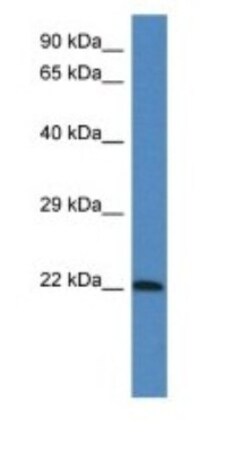 GRP Antibody, Novus Biologicals:Antibodies:Primary Antibodies