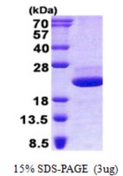 Novus Biologicals&trade;&nbsp;Recombinant Human GRP His Protein