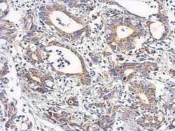 GRP75/HSPA9B/Mortalin Antibody, Novus Biologicals 0.1mL; Unlabeled:Antibodies,