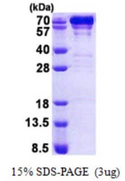 Novus Biologicals Recombinant Human GRP78/HSPA5 His Protein 0.1mg, Quantity: