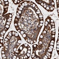 GRPEL2 Antibody, Novus Biologicals 25 &mu;L; Unlabeled:Antibodies, Polyclonal