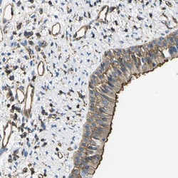 GRRP1 Antibody, Novus Biologicals 0.1mL; Unlabeled:Antibodies, Polyclonal