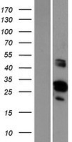 Novus Biologicals™ GRRP1 Overexpression Lysate