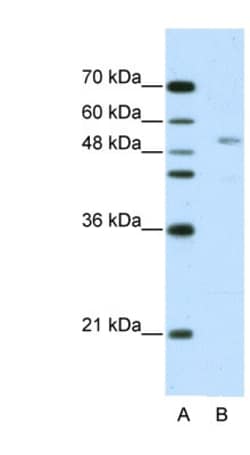 GRSF1 Antibody, Novus Biologicals 0.1mg; Unlabeled:Antibodies, Polyclonal