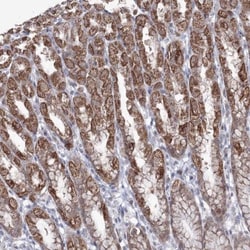 GRSF1 Antibody, Novus Biologicals 0.1mL; Unlabeled:Antibodies, Polyclonal