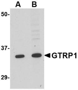 GRTP1 Antibody - BSA Free, Novus Biologicals 0.1 mg | Buy Online | Novus Biologicals | Fisher Scientific