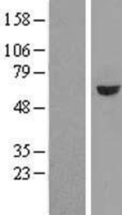 Novus Biologicals&trade;&nbsp;GRWD1 Overexpression Lysate