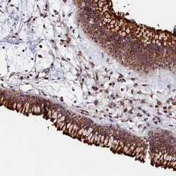 GRXCR1 Antibody, Novus Biologicals:Antibodies:Primary Antibodies