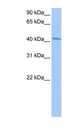 GSG1 Antibody, Novus Biologicals 100&mu;L; Unlabeled:Antibodies, Polyclonal