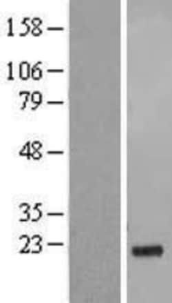Novus Biologicals™ GSG1L Overexpression Lysate