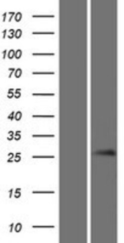 Novus Biologicals&trade;&nbsp;Gsh1 Overexpression Lysate