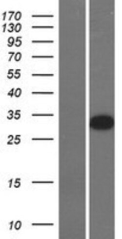 Novus Biologicals&trade;&nbsp;GSH2 Overexpression Lysate