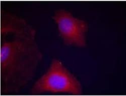 GSK-3 beta, p Tyr279, p Tyr216 Antibody, Novus Biologicals:Antibodies:Primary