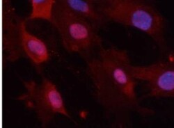 GSK-3 beta, p Tyr279, p Tyr216 Antibody, Novus Biologicals:Antibodies:Primary