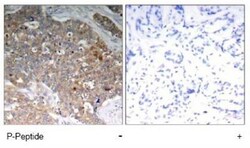 GSK-3 beta, p Tyr279, p Tyr216 Antibody, Novus Biologicals:Antibodies:Primary