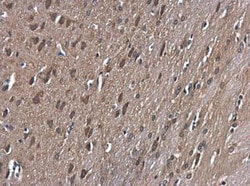 GSK-3 beta Antibody, Novus Biologicals 100 &mu;L | Buy Online | Novus Biologicals | Fisher Scientific