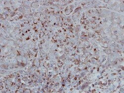 GSK-3 beta Antibody, Novus Biologicals 100 &mu;L | Buy Online | Novus Biologicals | Fisher Scientific