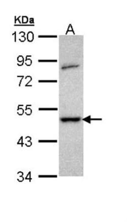 GSK-3 beta Antibody, Novus Biologicals 100 &mu;L | Buy Online | Novus Biologicals | Fisher Scientific