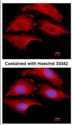 GSPT1 Antibody, Novus Biologicals 0.1mL; Unlabeled:Antibodies, Polyclonal
