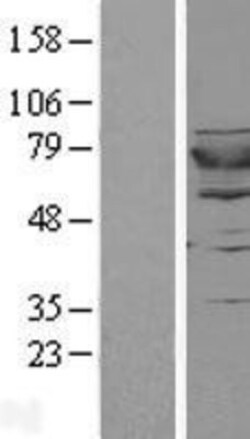 Novus Biologicals™ GSPT2 Overexpression Lysate