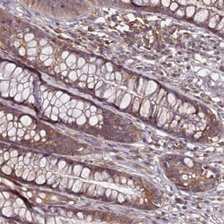 GSPT2 Antibody, Novus Biologicals 0.1mL; Unlabeled:Antibodies, Polyclonal