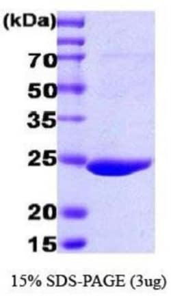 Novus Biologicals&trade;&nbsp;Recombinant GST Epitope Tag Protein