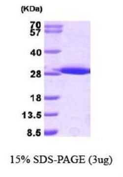 Novus Biologicals&trade;&nbsp;Recombinant Mouse GST Epitope Tag His Protein