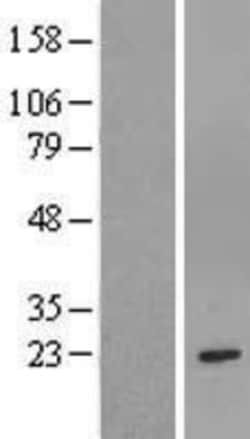 Novus Biologicals Glutathione S-Transferase mu 1/GSTM1 Overexpression Lysate 0.1 mg | Buy Online | Novus Biologicals&trade; | Fisher Scientific
