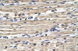 GSTM2 Antibody, Novus Biologicals 0.05mg; Unlabeled:Antibodies, Polyclonal