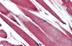 GSTM2 Antibody, Novus Biologicals 0.05mg; Unlabeled:Antibodies, Polyclonal