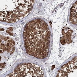 GSTM3 Antibody, Novus Biologicals:Antibodies:Primary Antibodies