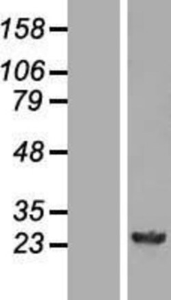 Novus Biologicals&trade;&nbsp;GSTM4 Overexpression Lysate