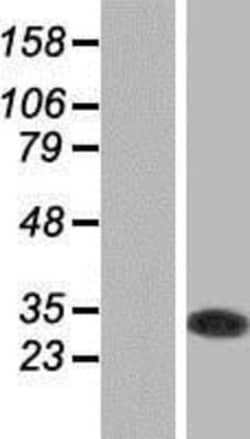 Novus Biologicals&trade;&nbsp;GSTO1 Overexpression Lysate