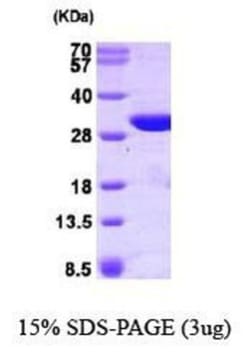 Novus Biologicals&trade;&nbsp;Recombinant Human GSTO1 Protein