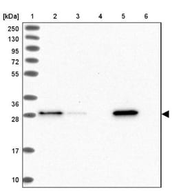GSTO1 Antibody, Novus Biologicals 0.1mL; Unlabeled:Antibodies, Polyclonal