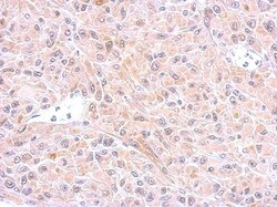 Glutathione S-Transferase pi 1/GSTP1 Antibody, Novus Biologicals 0.1mL;