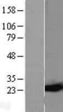 Novus Biologicals&trade;&nbsp;Glutathione S-Transferase pi 1/GSTP1 Overexpression Lysate