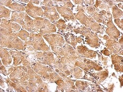 GSTT1 Antibody, Novus Biologicals 0.1mg; Unlabeled:Antibodies, Polyclonal