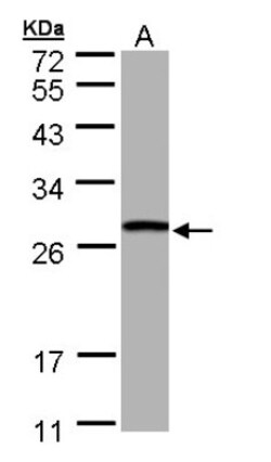 GSTT1 Antibody, Novus Biologicals 0.1mg; Unlabeled:Antibodies, Polyclonal