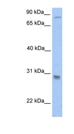 GSTT1 Antibody, Novus Biologicals 0.05mg; Unlabeled:Antibodies, Polyclonal