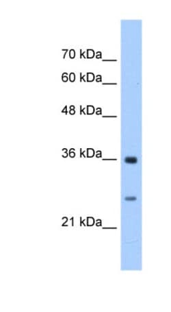 GSTZ1 Antibody, Novus Biologicals 100&mu;L; Unlabeled:Antibodies, Polyclonal