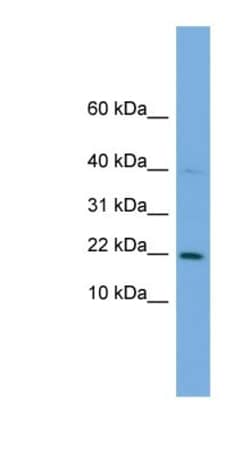 G-substrate Antibody, Novus Biologicals:Antibodies:Primary Antibodies