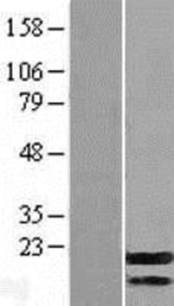Novus Biologicals&trade;&nbsp;G-substrate Overexpression Lysate