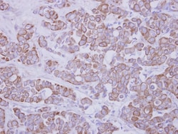GTDC1 Antibody, Novus Biologicals 0.1mL; Unlabeled:Antibodies, Polyclonal