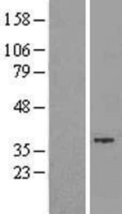 Novus Biologicals&trade;&nbsp;GTDC1 Overexpression Lysate