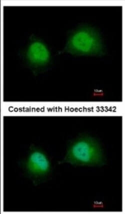 GTF2A1 Antibody, Novus Biologicals 0.1mL; Unlabeled:Antibodies, Polyclonal