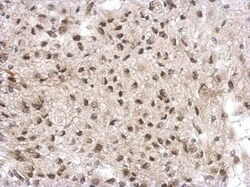 GTF2A1 Antibody, Novus Biologicals 0.1mL; Unlabeled:Antibodies, Polyclonal