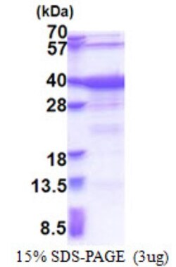 Novus Biologicals&trade;&nbsp;Recombinant Human GTF2A1 His Protein